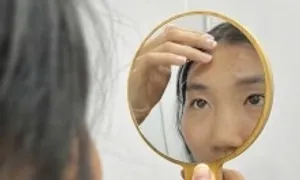 Dấu hiệu stress trên da Dấu hiệu stress trên da